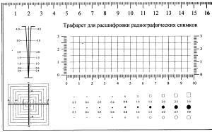 Трафарет для расшифровки радиографических снимков